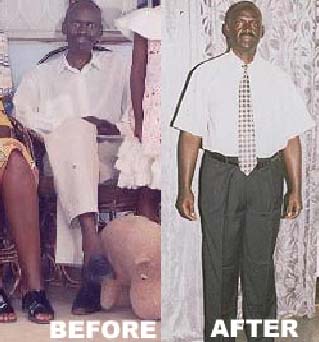 Before and after comparison showing a man in white clothing, appearing thinner on left and healthier on right